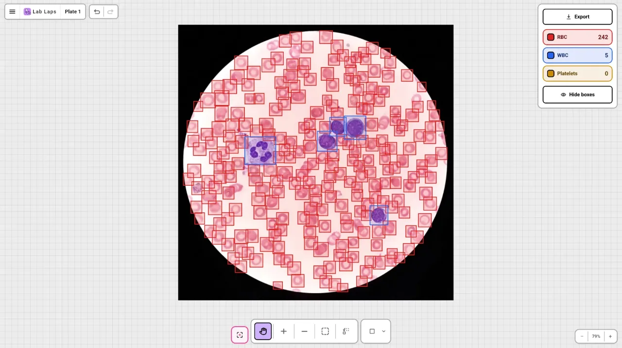 AI-assisted blood cell detection in the Lab Laps blood cell counter tool