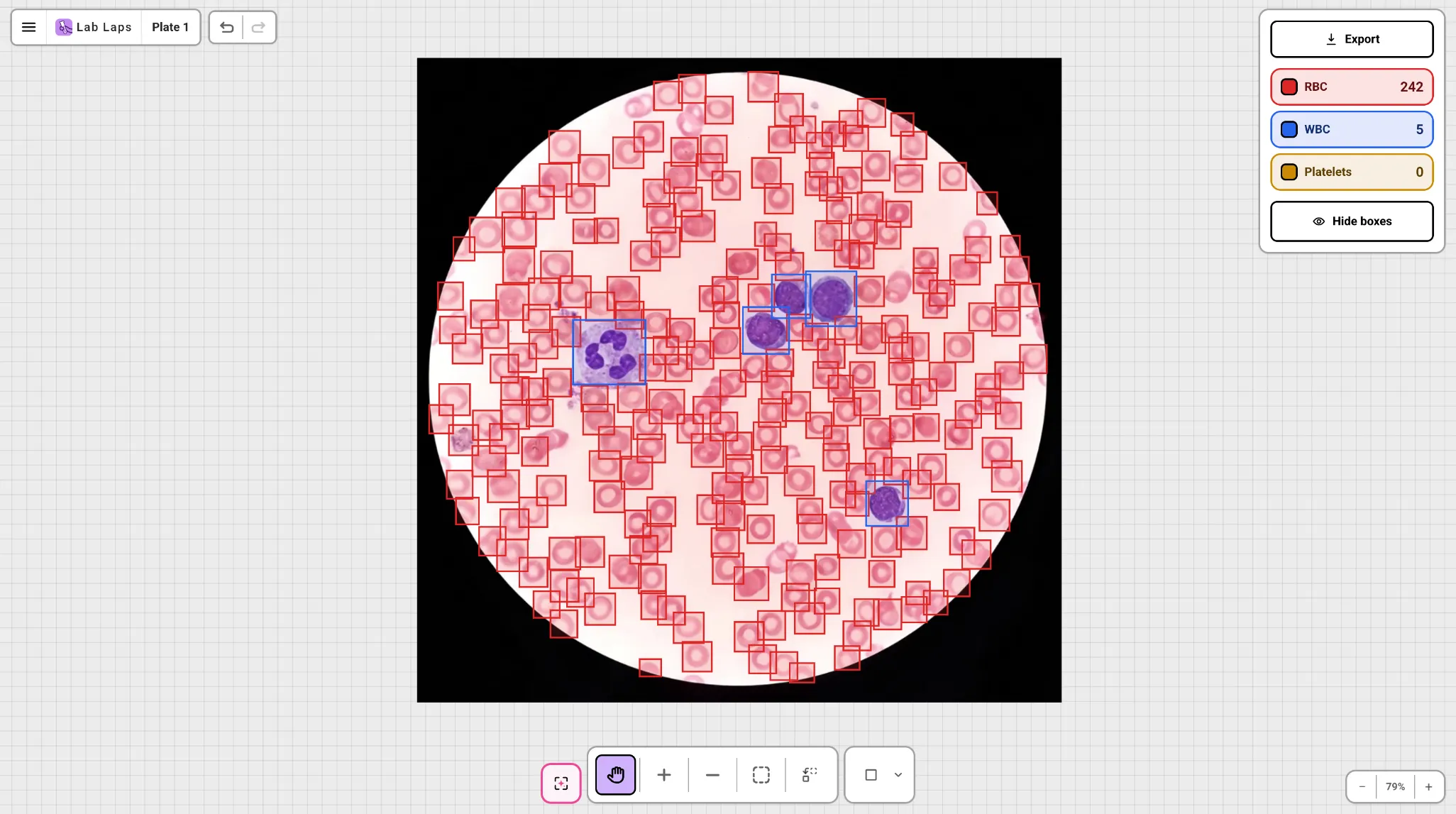 AI-assisted blood cell detection in the Lab Laps blood cell counter tool