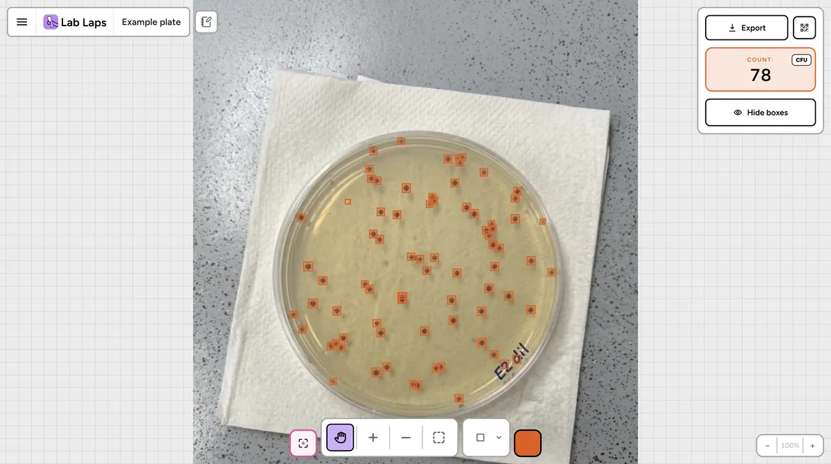 Agar plate with bacterial colonies automatically counted by AI in the colony counter tool
