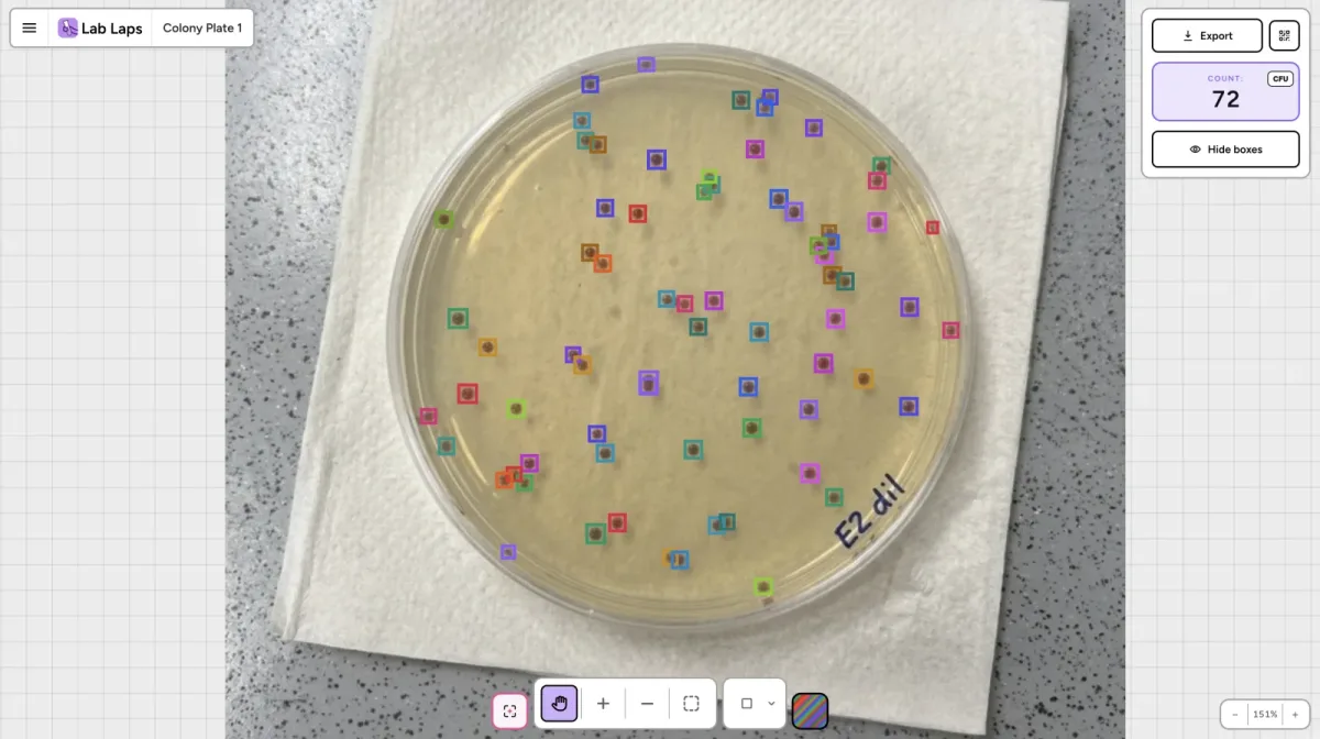 Agar plate with bacterial colonies automatically counted by AI in the colony counter tool